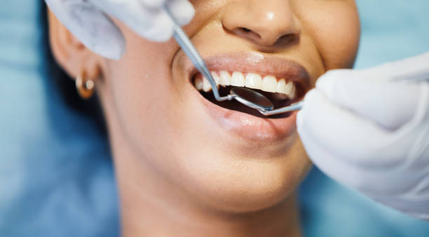 Best Emergency Dental Care for Broken or Chipped Teeth in Lake Mary, FL
