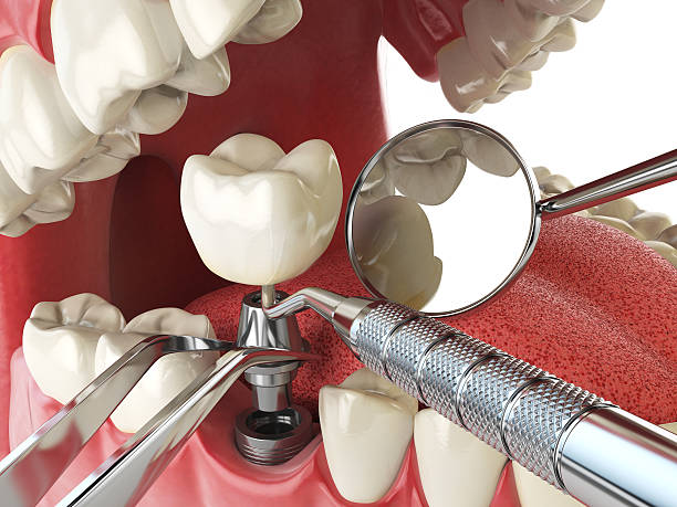 Best Weekend Emergency Dentist in Lake Mary, FL